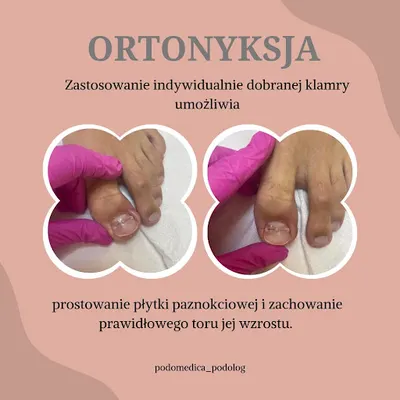 Podo Medica | Gabinet Podologiczny Gdynia | Podologia Trójmiasto